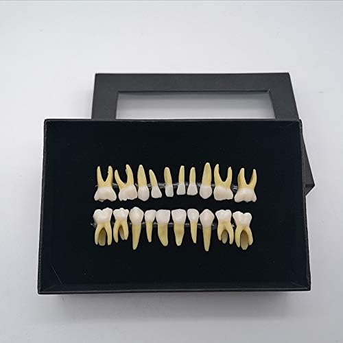 Стоматологичен модел KH66ZKY два цвята Модел на млечните зъби Отворена Pulp Изолирано Модел зъб за проучване на Обучение