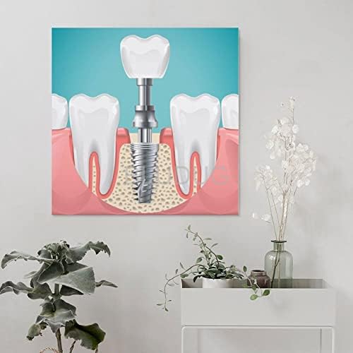 Плакат Стоматологична болница BLUDUG Плакат с Зубным Имплантат Стоматологични Плакати на Отпечатъци и Отпечатъци на Стената
